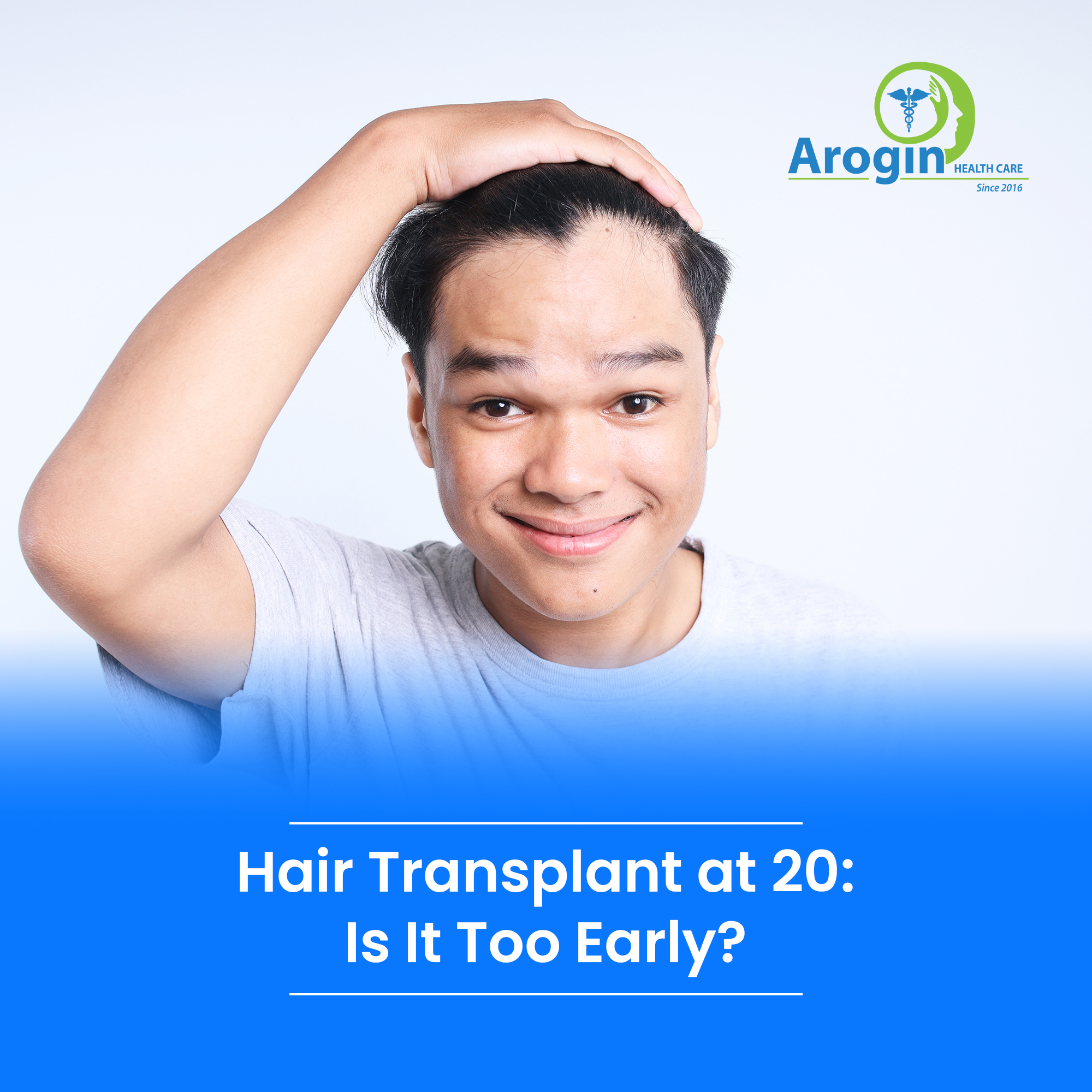 Hair Transplant at 20: Is It Too Early?