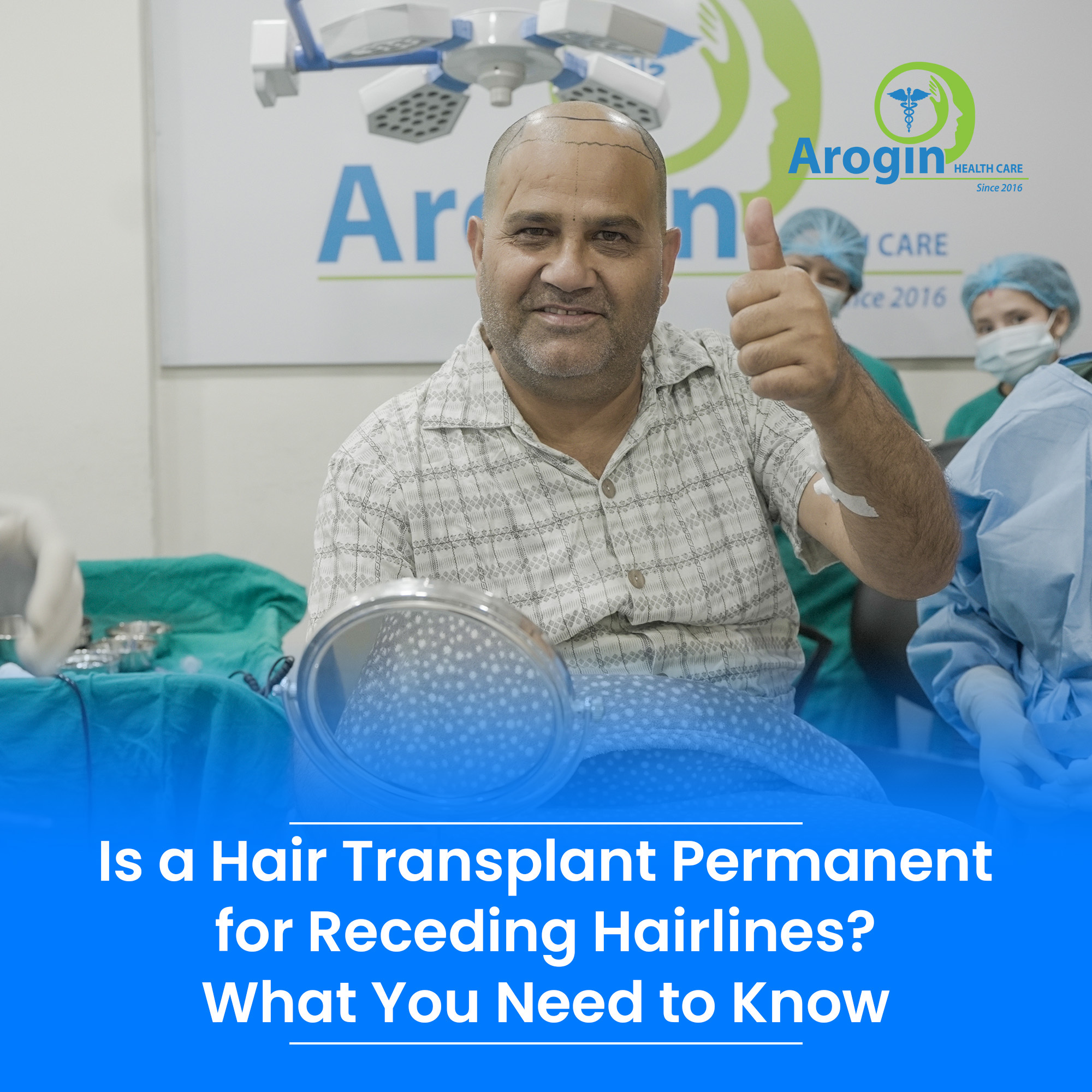 Is a Hair Transplant Permanent for Receding Hairlines? What You Need to Know